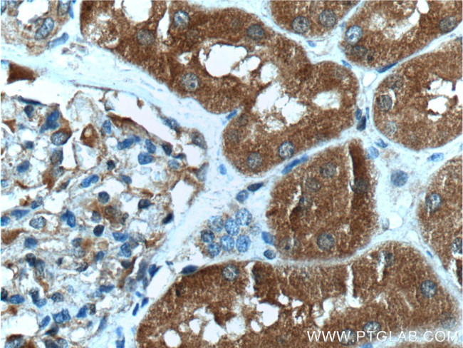 CLIC4 Antibody in Immunohistochemistry (Paraffin) (IHC (P))