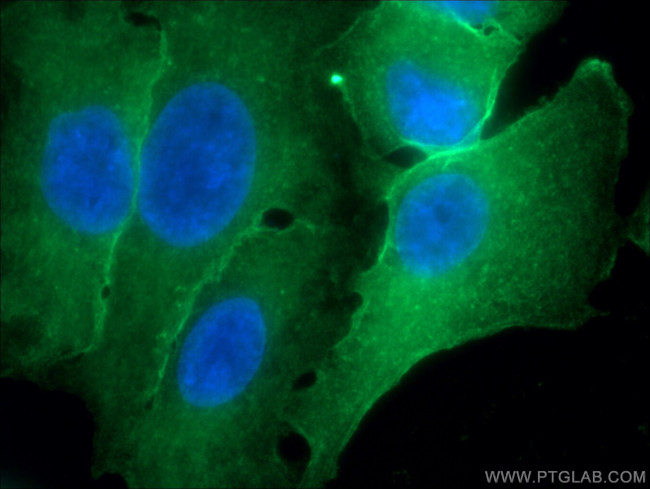 Annexin A1 Antibody in Immunocytochemistry (ICC/IF)