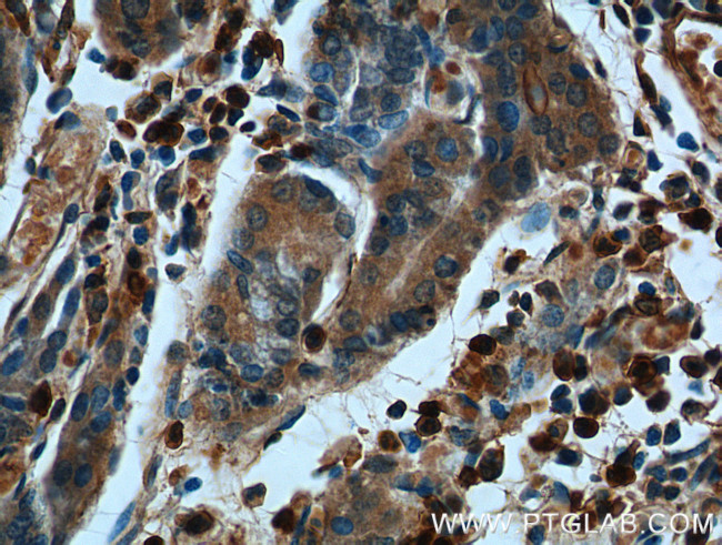 Annexin A1 Antibody in Immunohistochemistry (Paraffin) (IHC (P))