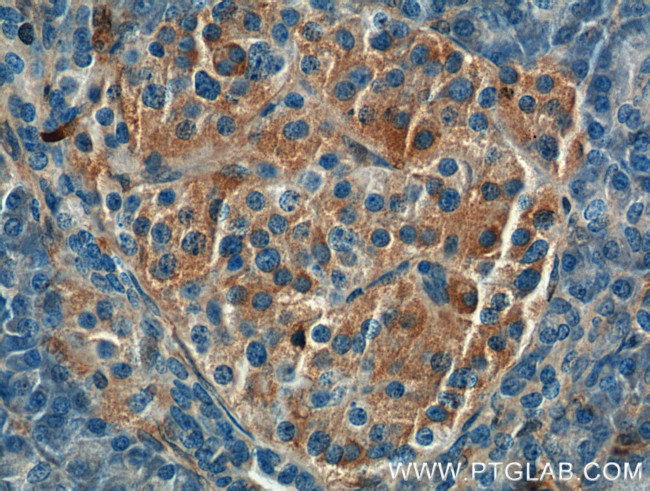 Annexin A1 Antibody in Immunohistochemistry (Paraffin) (IHC (P))