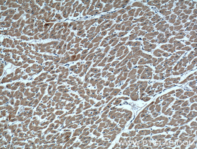 VDAC1/Porin Antibody in Immunohistochemistry (Paraffin) (IHC (P))