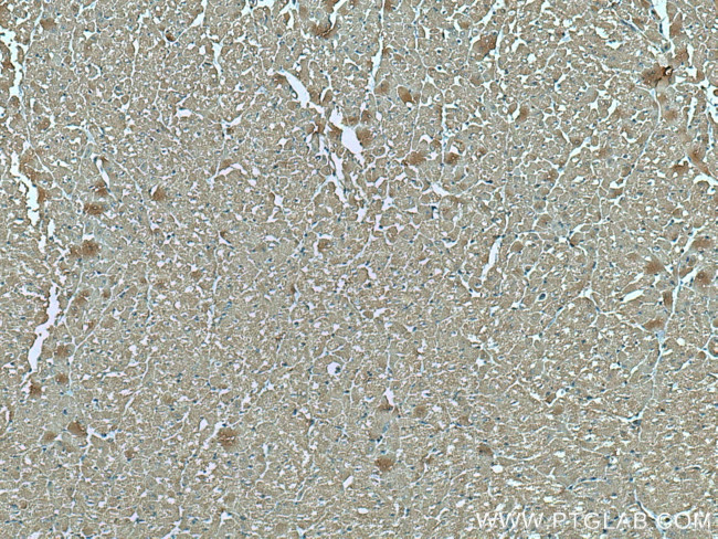 VDAC1/Porin Antibody in Immunohistochemistry (Paraffin) (IHC (P))