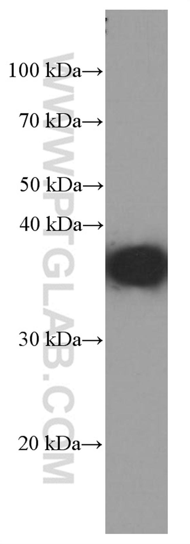 SIX2 Antibody in Western Blot (WB)