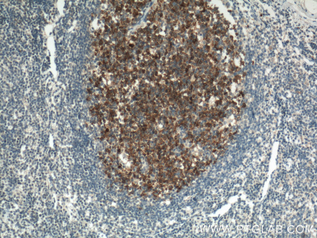 TLR4 Antibody in Immunohistochemistry (Paraffin) (IHC (P))