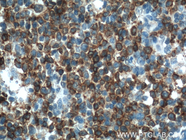 TLR4 Antibody in Immunohistochemistry (Paraffin) (IHC (P))