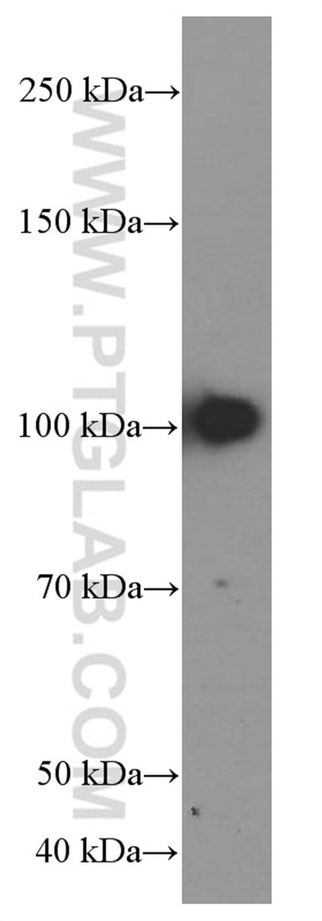 TLR4 Antibody in Western Blot (WB)