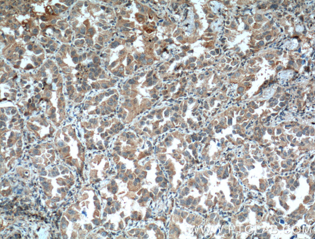 COX2/ Cyclooxygenase 2 Antibody in Immunohistochemistry (Paraffin) (IHC (P))