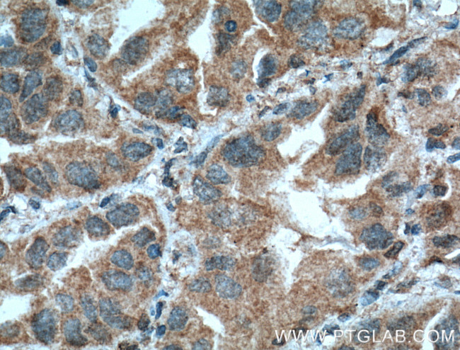 COX2/ Cyclooxygenase 2 Antibody in Immunohistochemistry (Paraffin) (IHC (P))