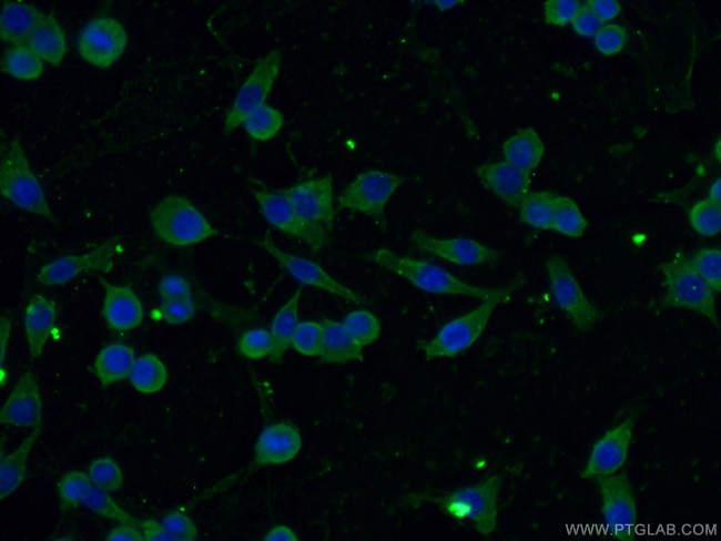 CBLB Antibody in Immunocytochemistry (ICC/IF)