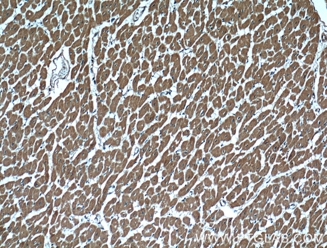 CBLB Antibody in Immunohistochemistry (Paraffin) (IHC (P))