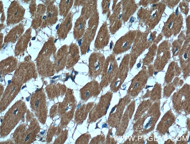 CBLB Antibody in Immunohistochemistry (Paraffin) (IHC (P))