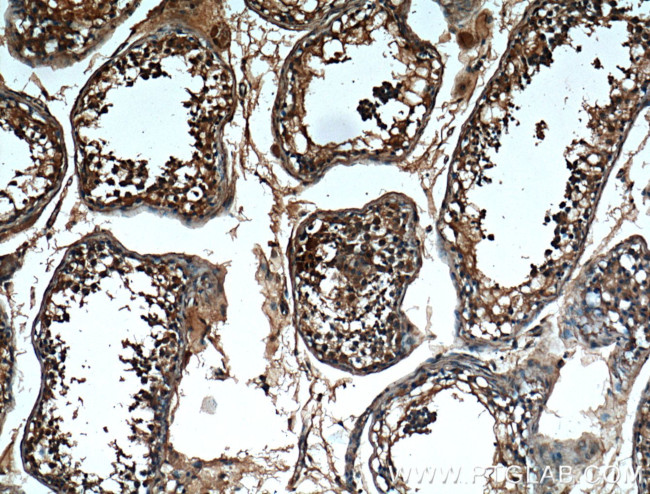 CBLB Antibody in Immunohistochemistry (Paraffin) (IHC (P))