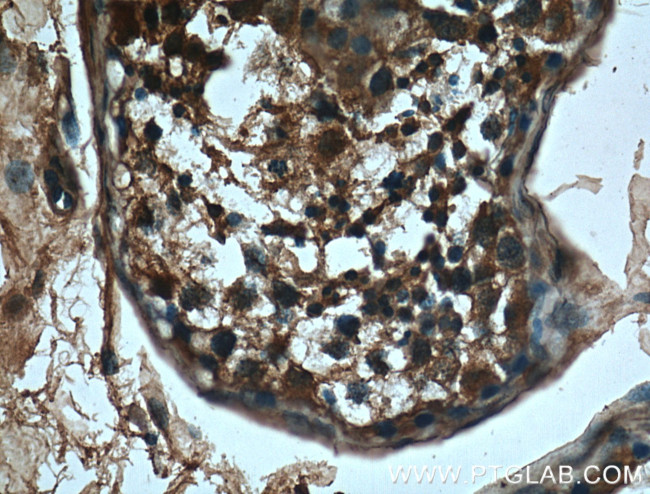 CBLB Antibody in Immunohistochemistry (Paraffin) (IHC (P))