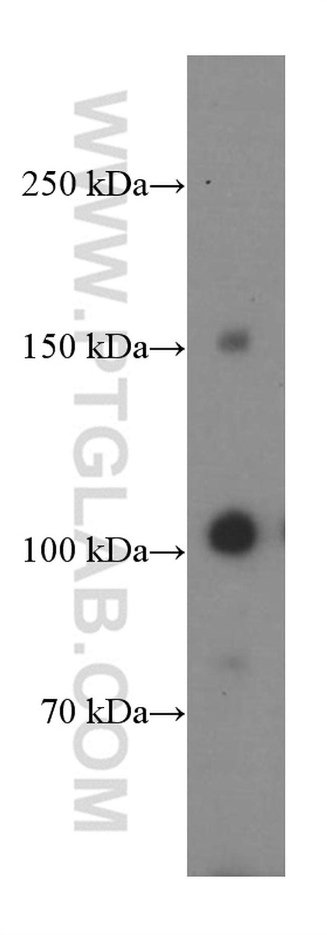 CBLB Antibody in Western Blot (WB)