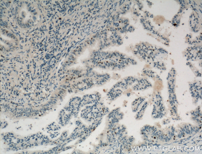 Cyclin D3 Antibody in Immunohistochemistry (Paraffin) (IHC (P))