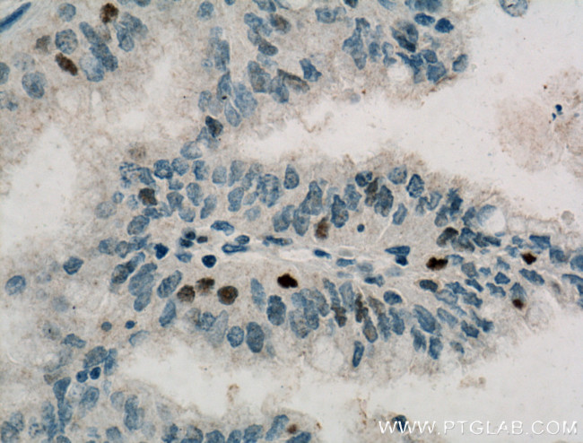 Cyclin D3 Antibody in Immunohistochemistry (Paraffin) (IHC (P))