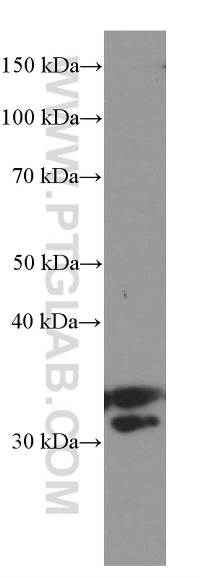 Cyclin D3 Antibody in Western Blot (WB)