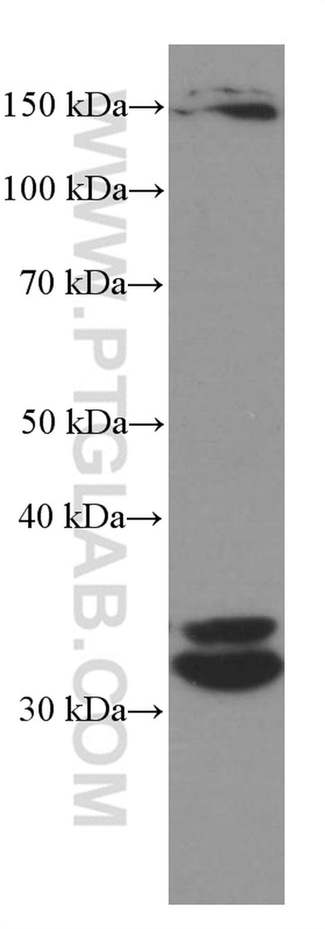 Cyclin D3 Antibody in Western Blot (WB)