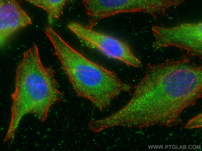 ACTH Antibody in Immunocytochemistry (ICC/IF)