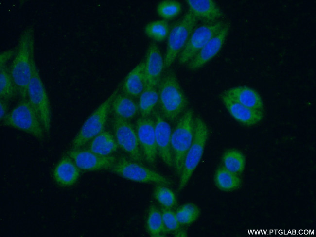 ACTH Antibody in Immunocytochemistry (ICC/IF)