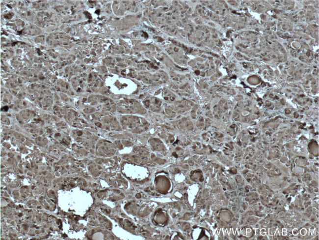 ACTH Antibody in Immunohistochemistry (Paraffin) (IHC (P))