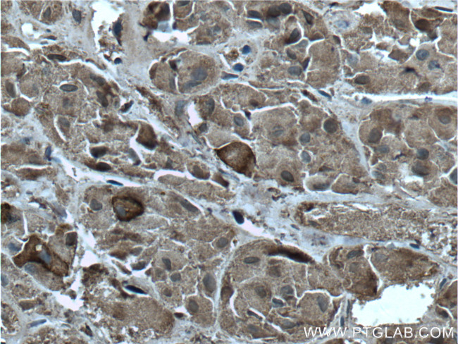 ACTH Antibody in Immunohistochemistry (Paraffin) (IHC (P))