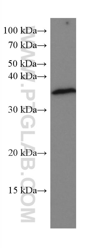 ACTH Antibody in Western Blot (WB)