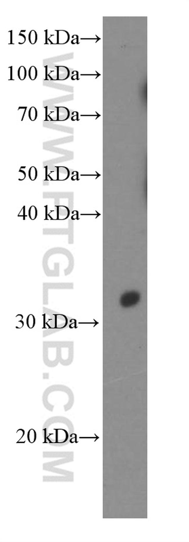 ACTH Antibody in Western Blot (WB)