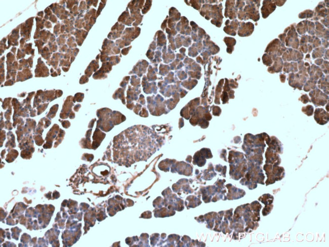 ACTH Antibody in Immunohistochemistry (Paraffin) (IHC (P))