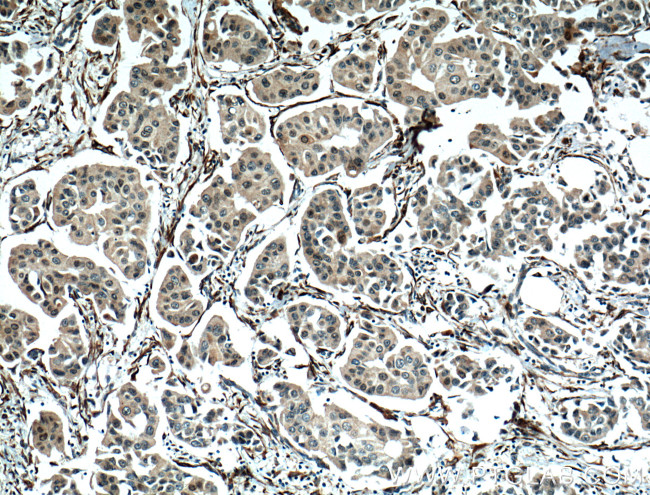 NUP155 Antibody in Immunohistochemistry (Paraffin) (IHC (P))