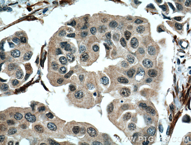 NUP155 Antibody in Immunohistochemistry (Paraffin) (IHC (P))