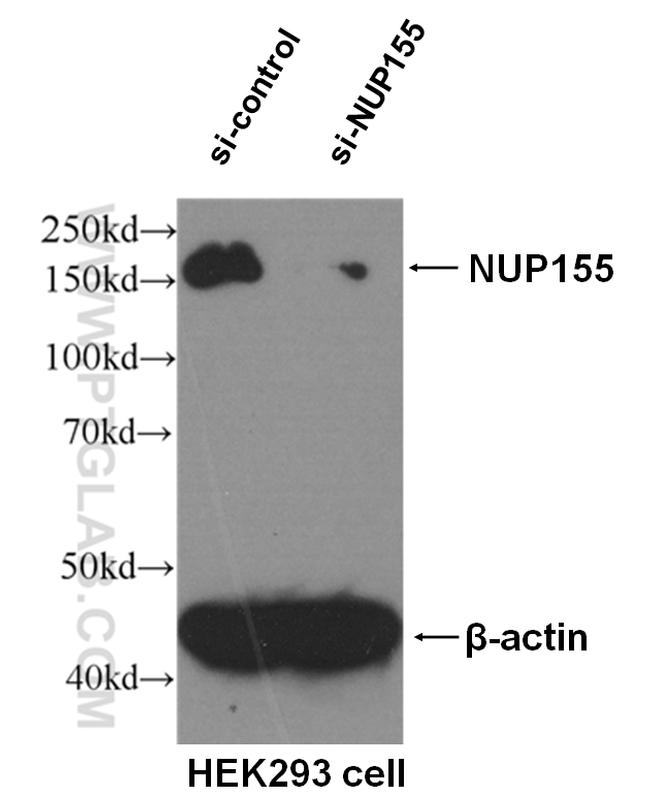 NUP155 Antibody in Western Blot (WB)