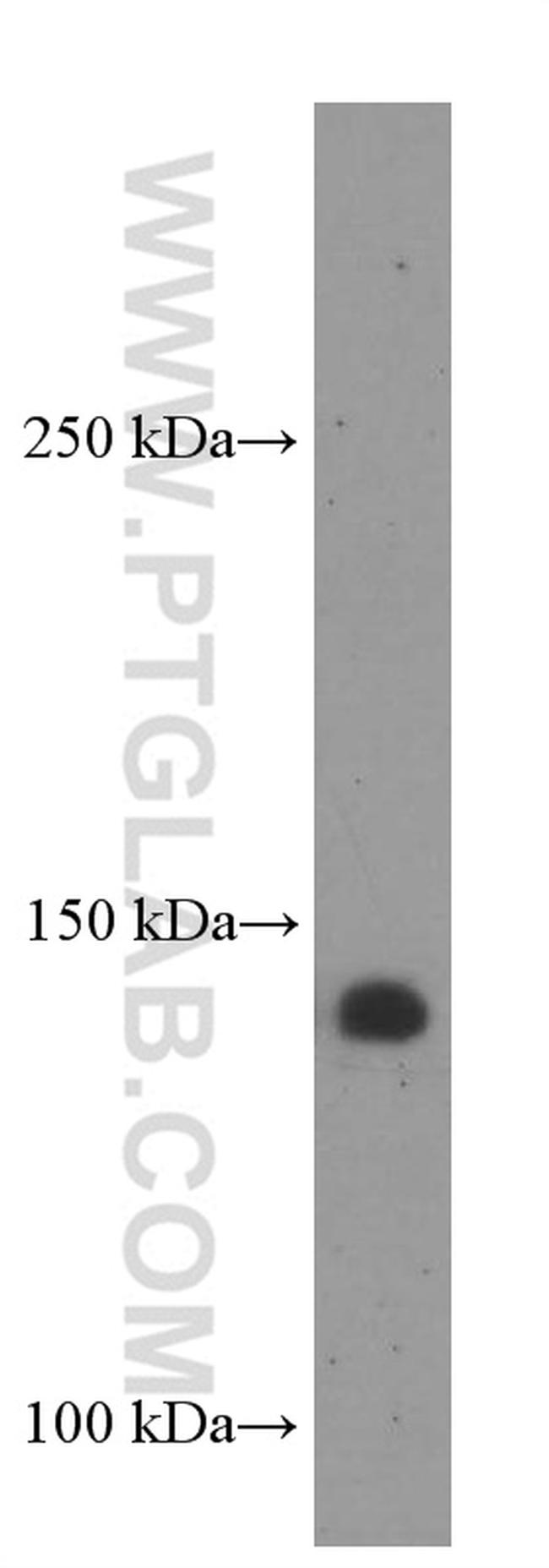 NUP155 Antibody in Western Blot (WB)