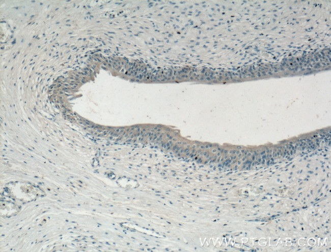 CHRNA5 Antibody in Immunohistochemistry (Paraffin) (IHC (P))