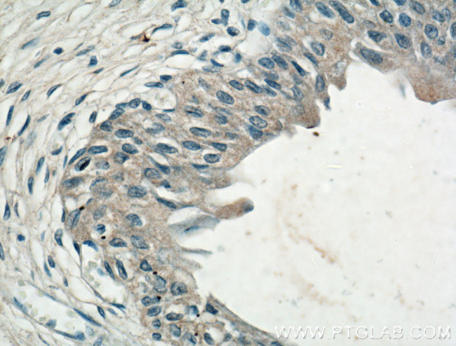 CHRNA5 Antibody in Immunohistochemistry (Paraffin) (IHC (P))