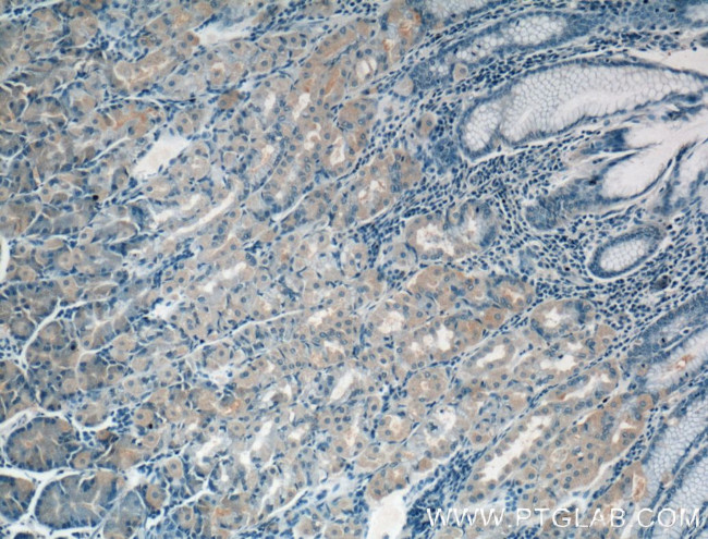 CHRNA5 Antibody in Immunohistochemistry (Paraffin) (IHC (P))