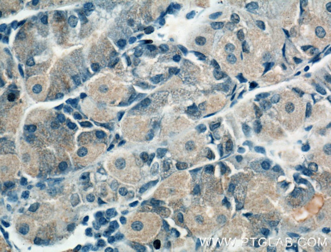 CHRNA5 Antibody in Immunohistochemistry (Paraffin) (IHC (P))