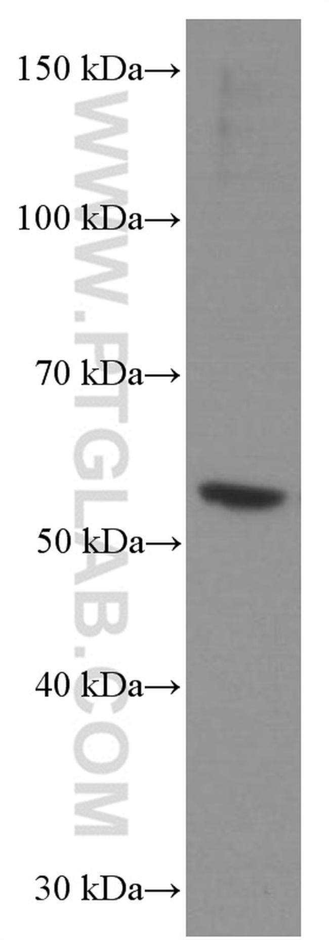 CHRNA5 Antibody in Western Blot (WB)