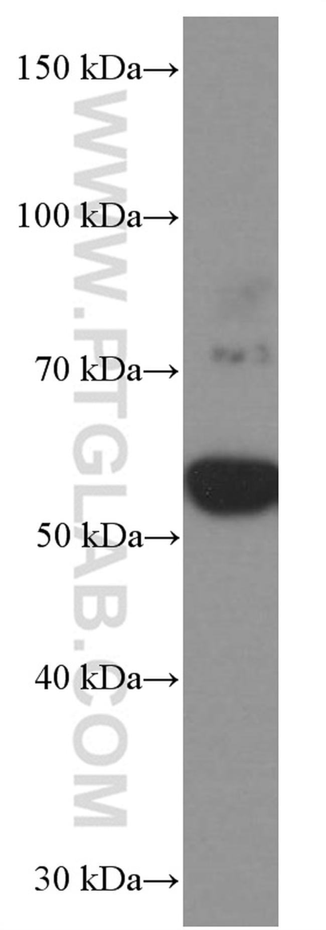 CHRNA5 Antibody in Western Blot (WB)