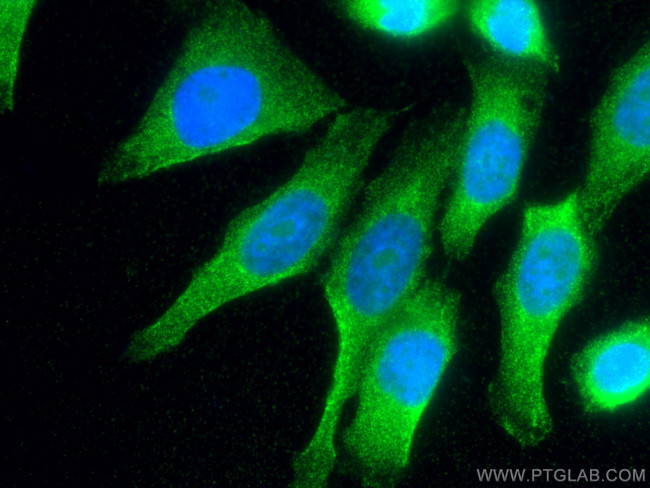 D2HGDH Antibody in Immunocytochemistry (ICC/IF)