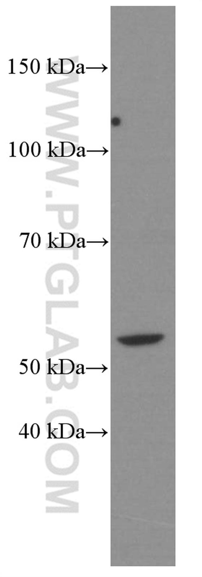 D2HGDH Antibody in Western Blot (WB)