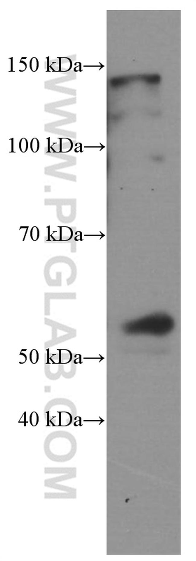 D2HGDH Antibody in Western Blot (WB)