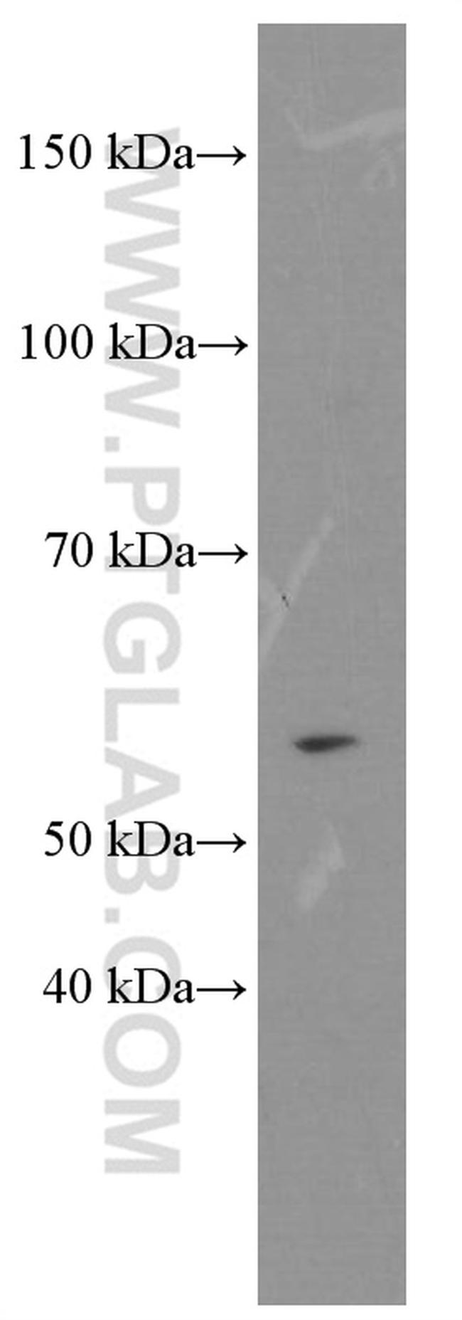 D2HGDH Antibody in Western Blot (WB)