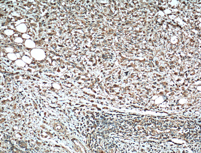 MMP2 Antibody in Immunohistochemistry (Paraffin) (IHC (P))