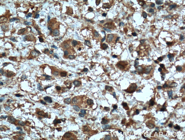 MMP2 Antibody in Immunohistochemistry (Paraffin) (IHC (P))