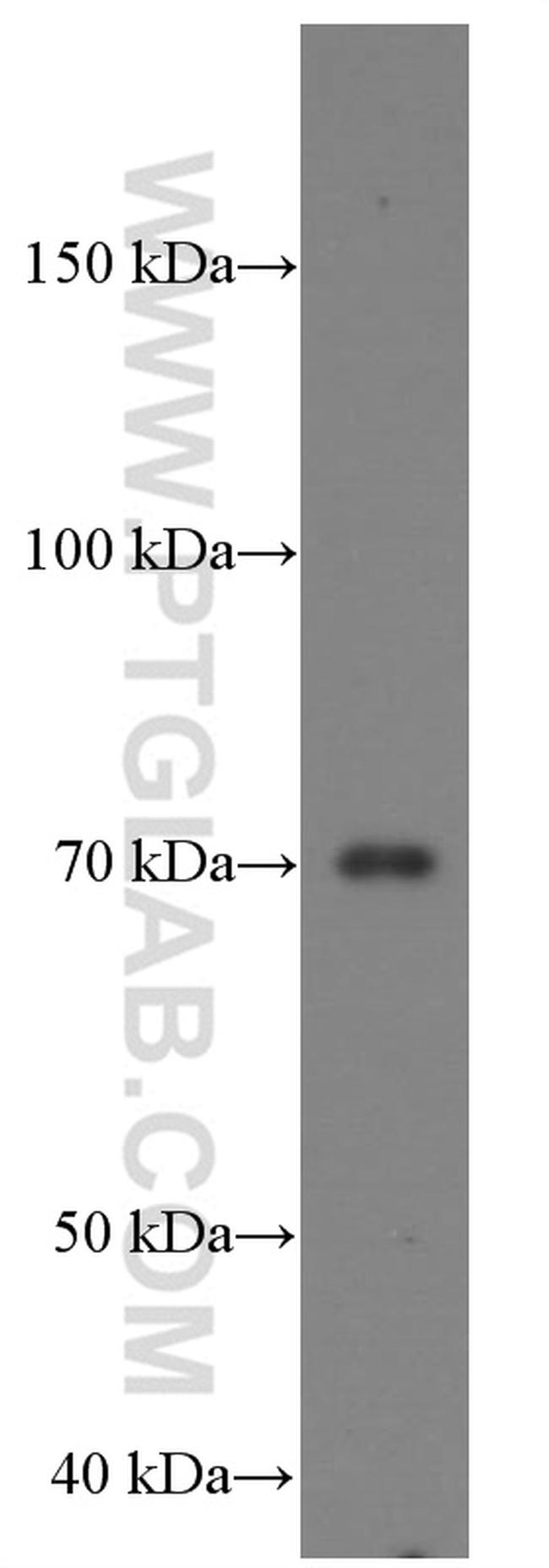 MMP2 Antibody in Western Blot (WB)