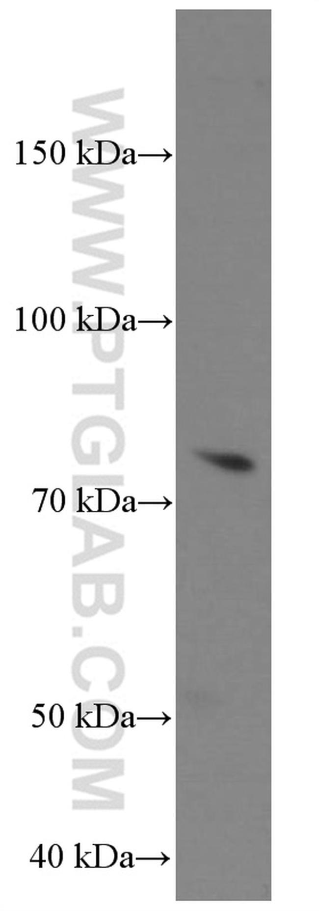 MMP2 Antibody in Western Blot (WB)