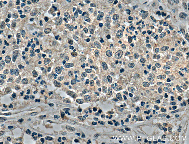 SKAP2 Antibody in Immunohistochemistry (Paraffin) (IHC (P))