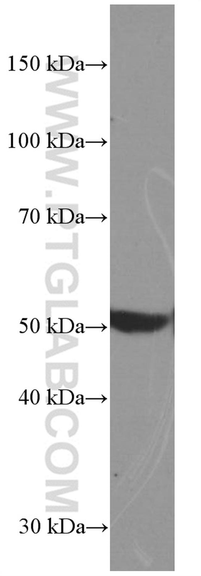 BMP5 Antibody in Western Blot (WB)