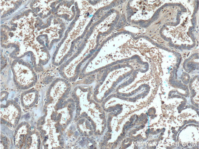 PGRMC1 Antibody in Immunohistochemistry (Paraffin) (IHC (P))